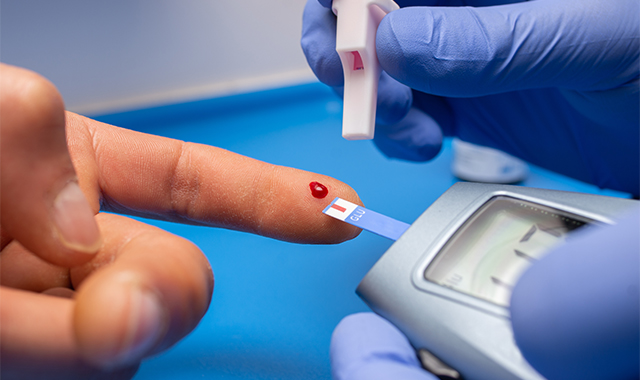 Asas filem PET perubatan untuk diagnostik IVD